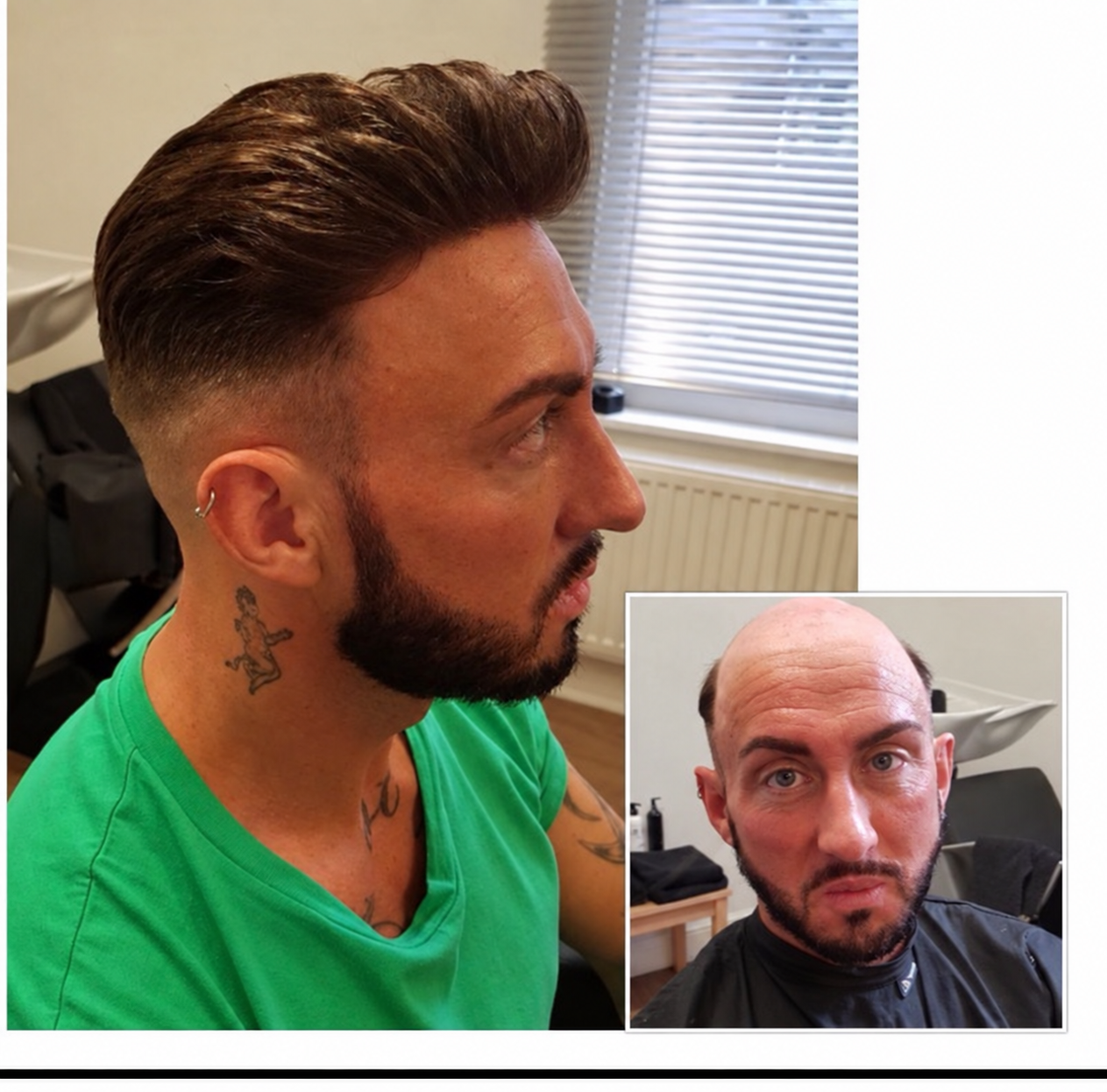 HLC example showing a styled hair replacement system and a before inset